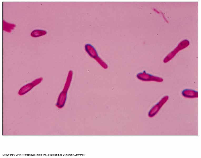  clostridium tetani